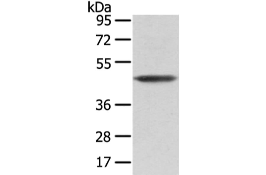 VASH1 Antibody from Signalway Antibody (42827) - Antibodies.com