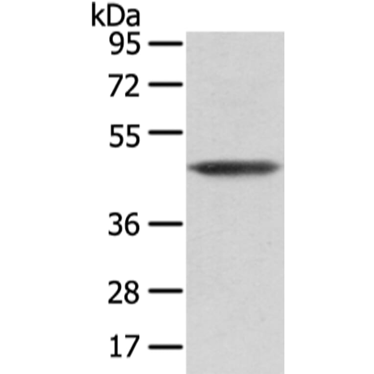 VASH1 Antibody from Signalway Antibody (42827) - Antibodies.com