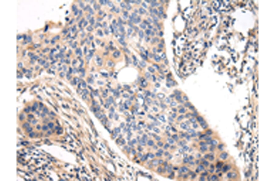 Immunohistochemistry - VASH1 Antibody from Signalway Antibody (42827) - Antibodies.com