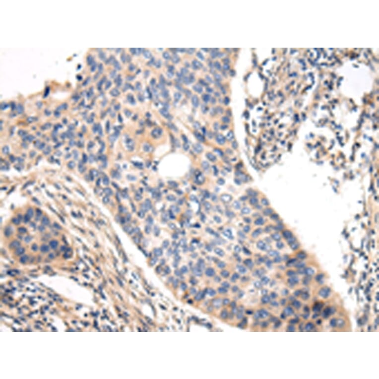Immunohistochemistry - VASH1 Antibody from Signalway Antibody (42827) - Antibodies.com