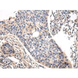Immunohistochemistry - VASH1 Antibody from Signalway Antibody (42827) - Antibodies.com