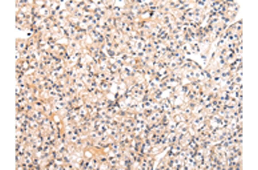 Immunohistochemistry - VASH1 Antibody from Signalway Antibody (42827) - Antibodies.com