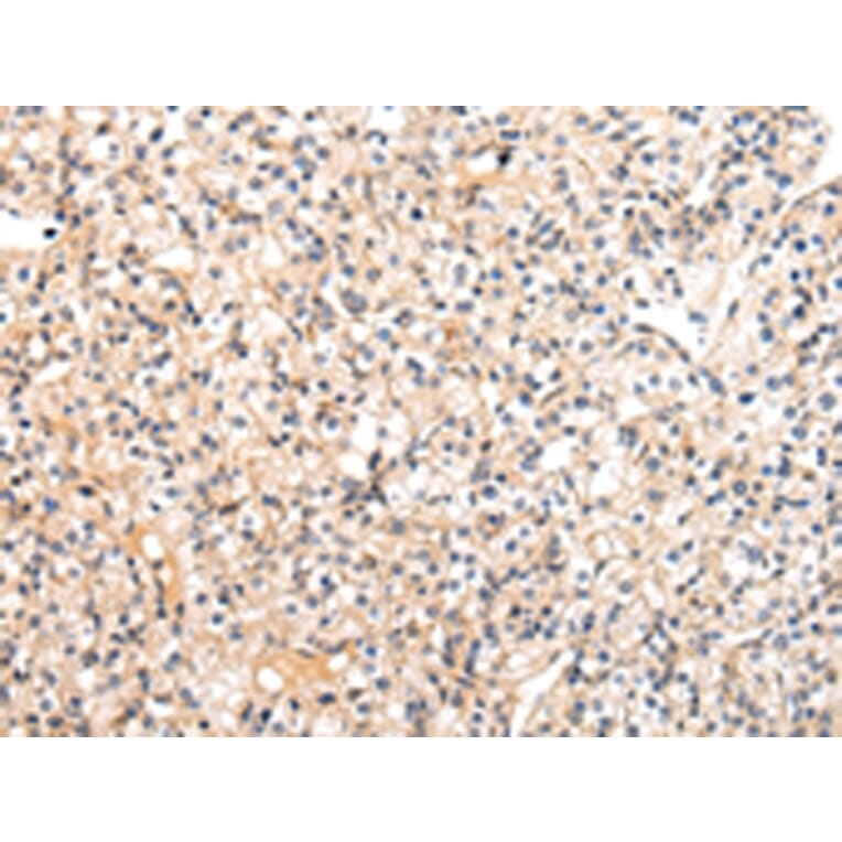 Immunohistochemistry - VASH1 Antibody from Signalway Antibody (42827) - Antibodies.com