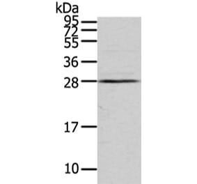 VDAC3 Antibody from Signalway Antibody (42830) - Antibodies.com