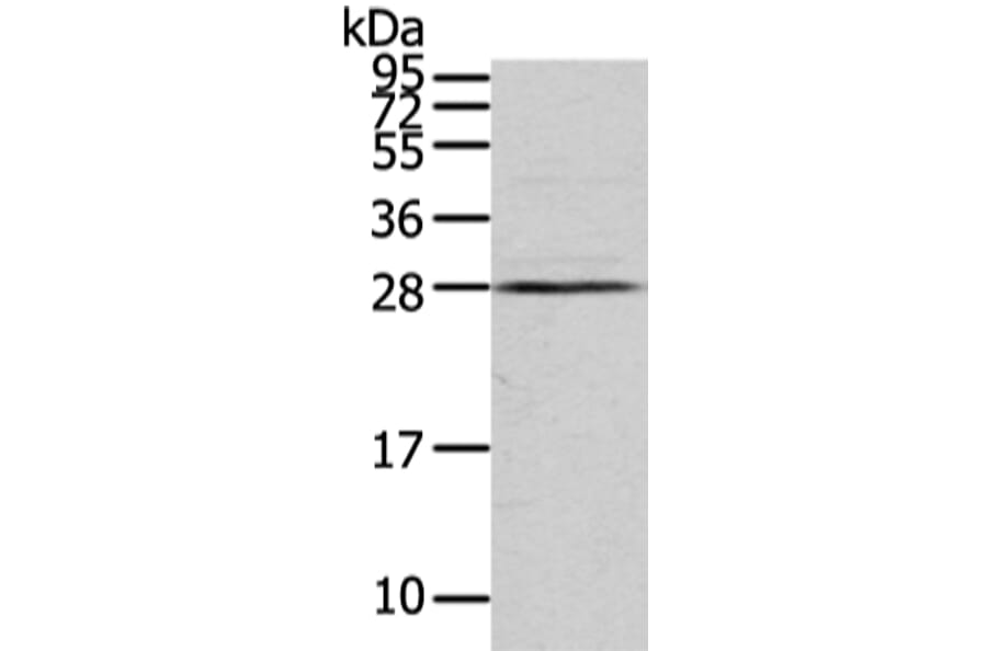 VDAC3 Antibody from Signalway Antibody (42830) - Antibodies.com