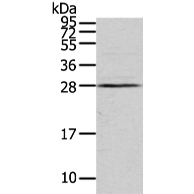 VDAC3 Antibody from Signalway Antibody (42830) - Antibodies.com