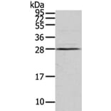 VDAC3 Antibody from Signalway Antibody (42830) - Antibodies.com