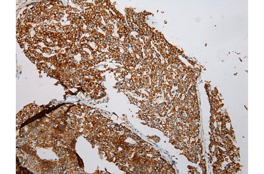 Immunohistochemistry - VDAC3 Antibody from Signalway Antibody (42830) - Antibodies.com