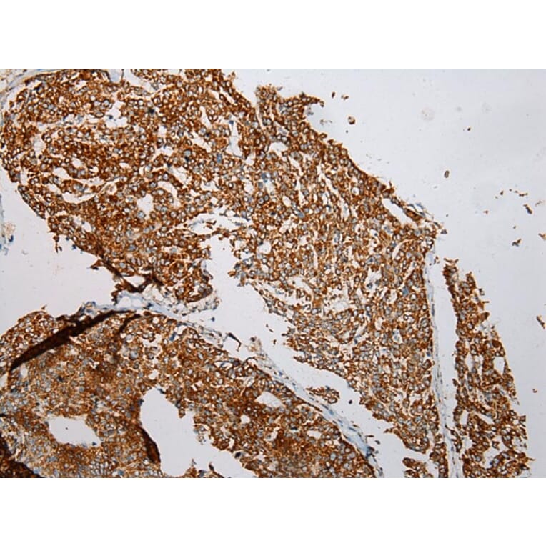 Immunohistochemistry - VDAC3 Antibody from Signalway Antibody (42830) - Antibodies.com