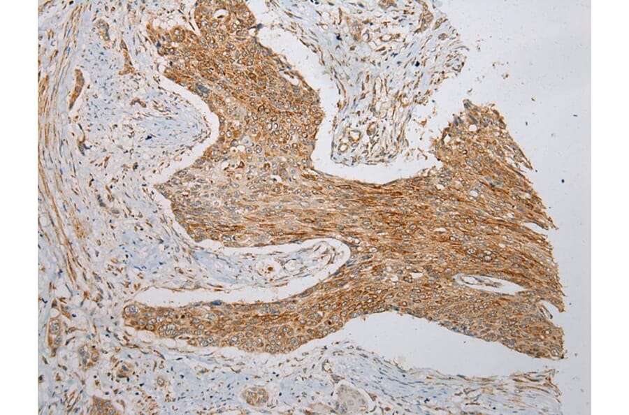 Immunohistochemistry - VDAC3 Antibody from Signalway Antibody (42830) - Antibodies.com