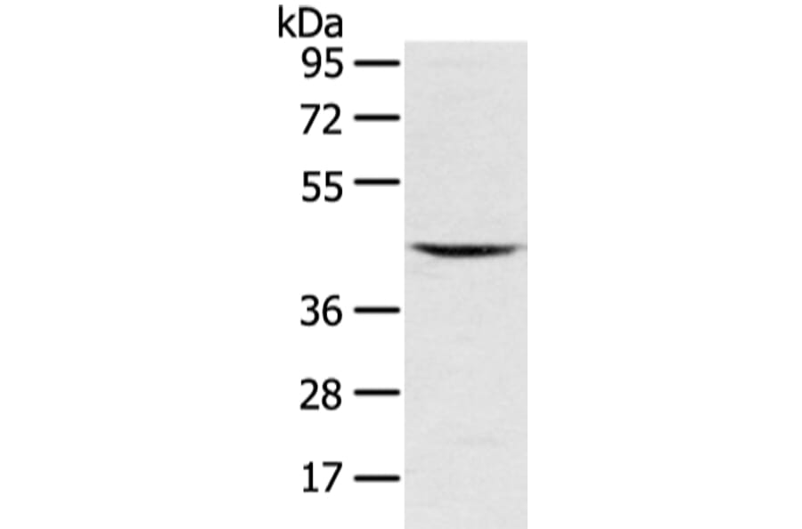 VSIG8 Antibody from Signalway Antibody (42833) - Antibodies.com