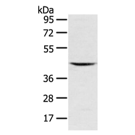 VSIG8 Antibody from Signalway Antibody (42833) - Antibodies.com