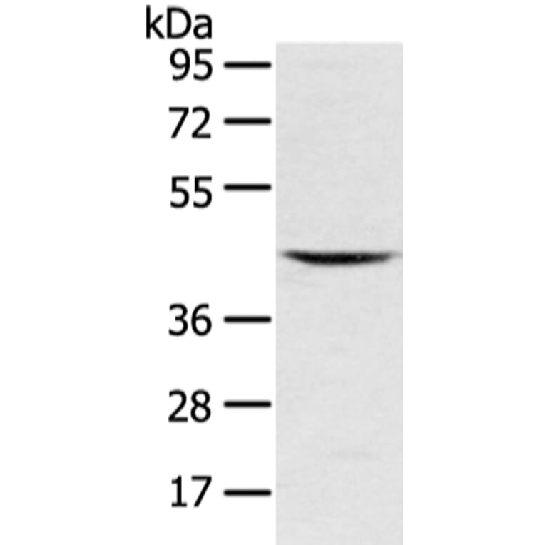 VSIG8 Antibody from Signalway Antibody (42833) - Antibodies.com