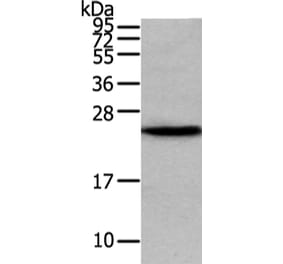 VPS28 Antibody from Signalway Antibody (42836) - Antibodies.com