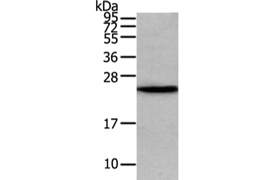 VPS28 Antibody from Signalway Antibody (42836) - Antibodies.com