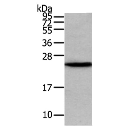 VPS28 Antibody from Signalway Antibody (42836) - Antibodies.com