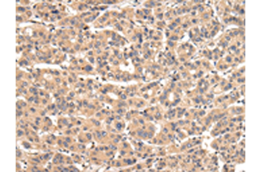 Immunohistochemistry - VPS35 Antibody from Signalway Antibody (42841) - Antibodies.com