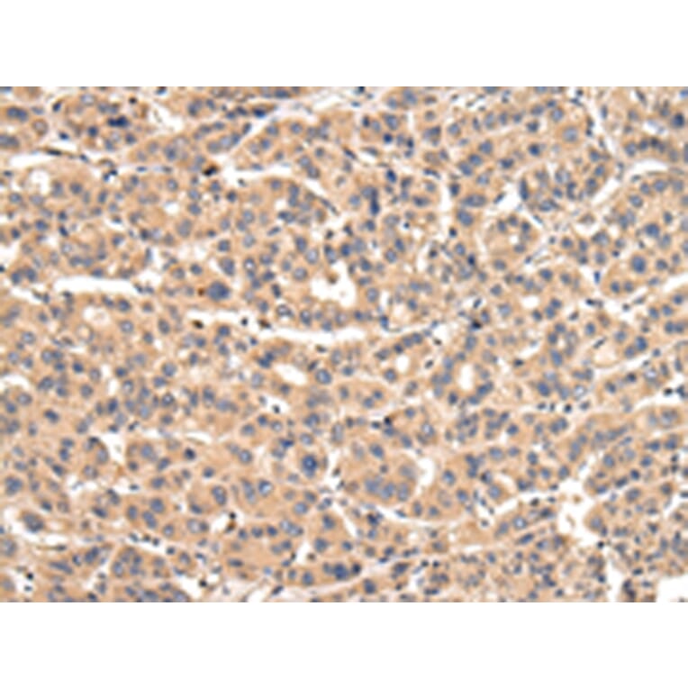 Immunohistochemistry - VPS35 Antibody from Signalway Antibody (42841) - Antibodies.com