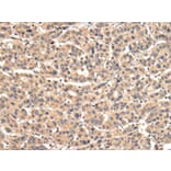 Immunohistochemistry - VPS35 Antibody from Signalway Antibody (42841) - Antibodies.com