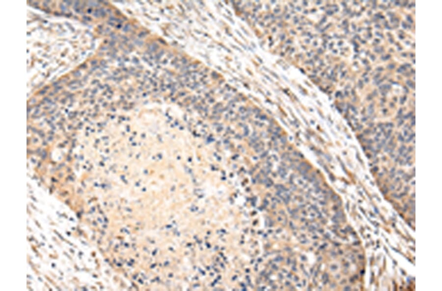 Immunohistochemistry - VPS35 Antibody from Signalway Antibody (42841) - Antibodies.com