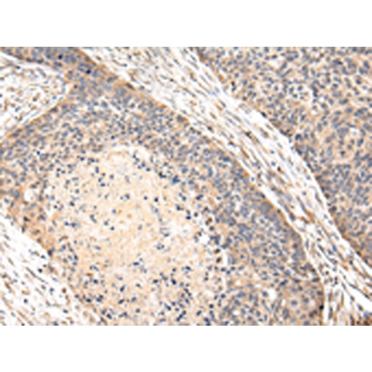 Immunohistochemistry - VPS35 Antibody from Signalway Antibody (42841) - Antibodies.com