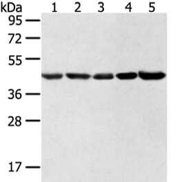 WDR77 Antibody from Signalway Antibody (42856) - Antibodies.com