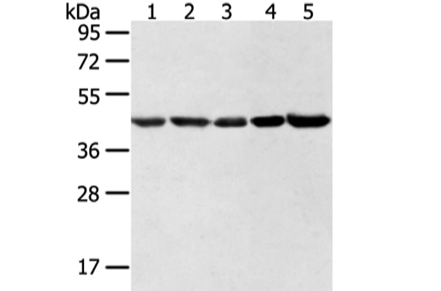 WDR77 Antibody from Signalway Antibody (42856) - Antibodies.com