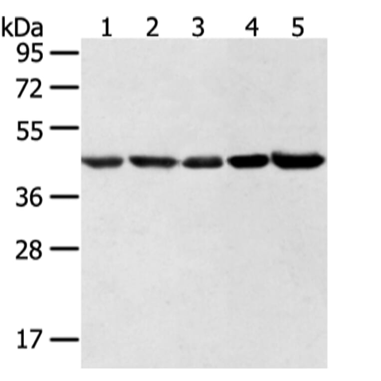 WDR77 Antibody from Signalway Antibody (42856) - Antibodies.com