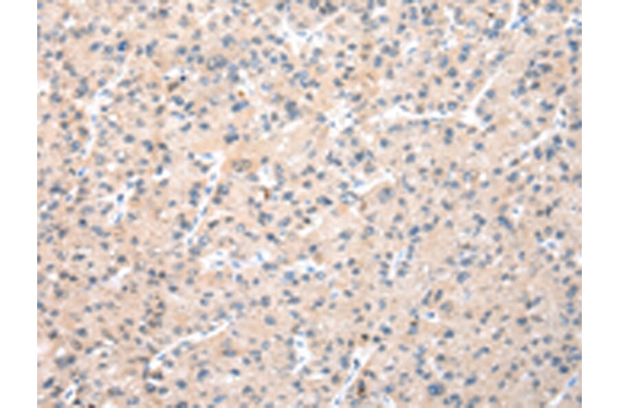 Immunohistochemistry - WDR77 Antibody from Signalway Antibody (42856) - Antibodies.com