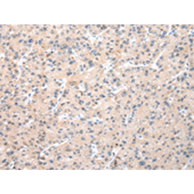 Immunohistochemistry - WDR77 Antibody from Signalway Antibody (42856) - Antibodies.com