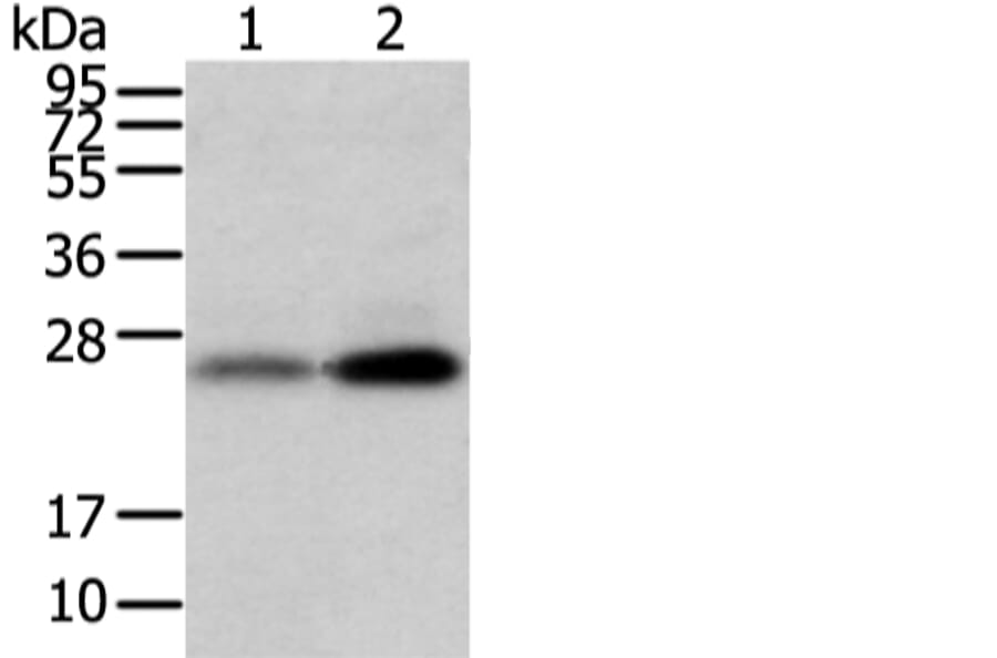 WFDC5 Antibody from Signalway Antibody (42857) - Antibodies.com
