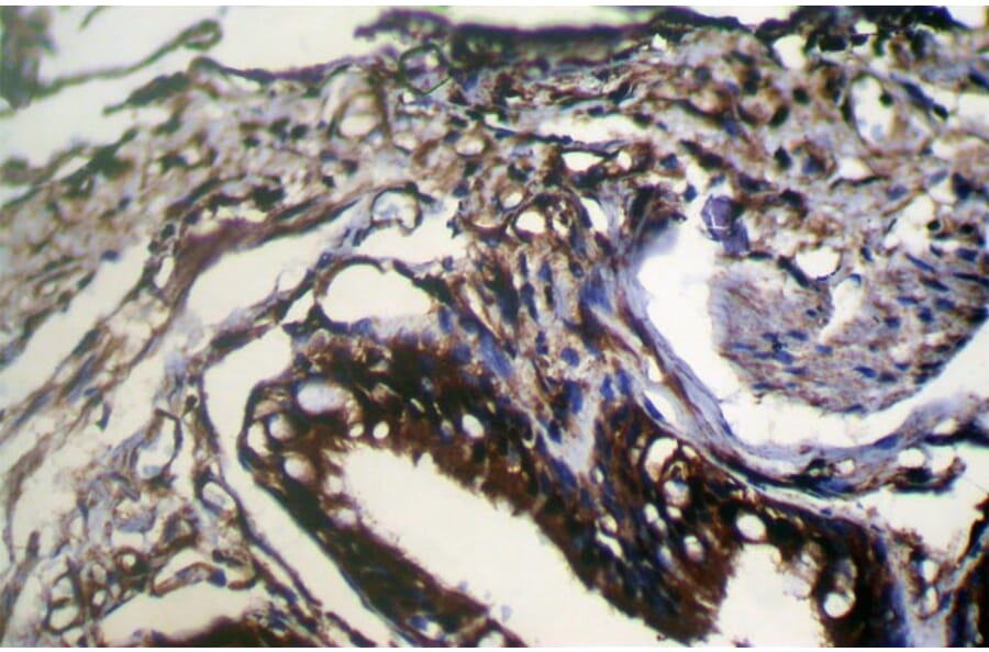 Immunohistochemistry - WFDC5 Antibody from Signalway Antibody (42857) - Antibodies.com