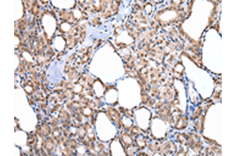 Immunohistochemistry - MORC2 Antibody from Signalway Antibody (42867) - Antibodies.com