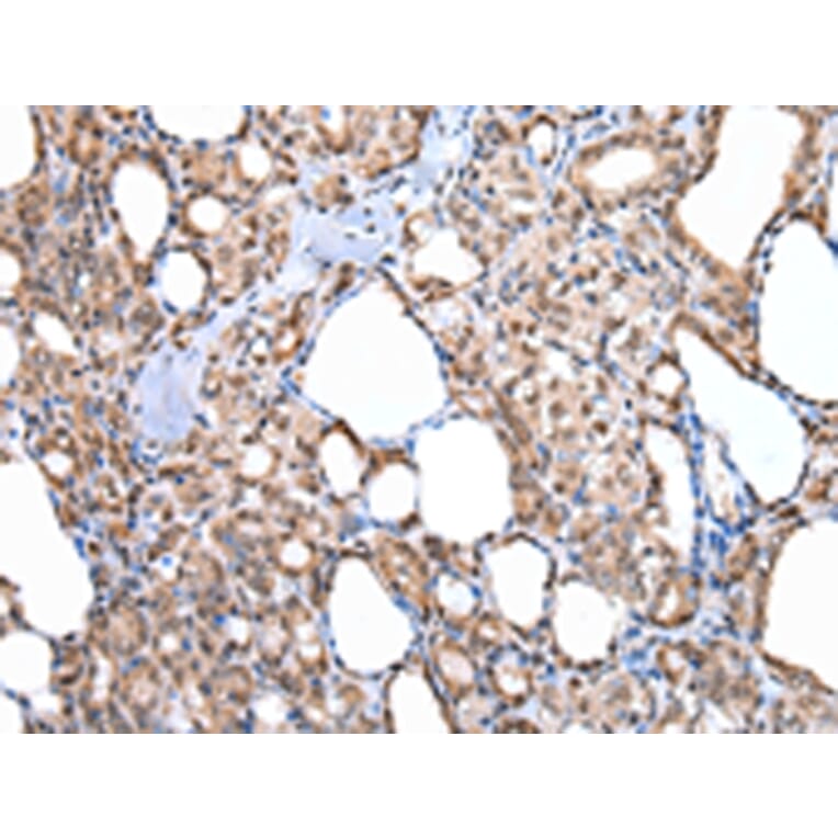 Immunohistochemistry - MORC2 Antibody from Signalway Antibody (42867) - Antibodies.com