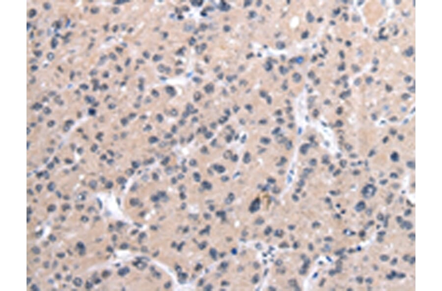 Immunohistochemistry - MORC2 Antibody from Signalway Antibody (42867) - Antibodies.com
