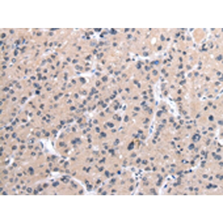 Immunohistochemistry - MORC2 Antibody from Signalway Antibody (42867) - Antibodies.com
