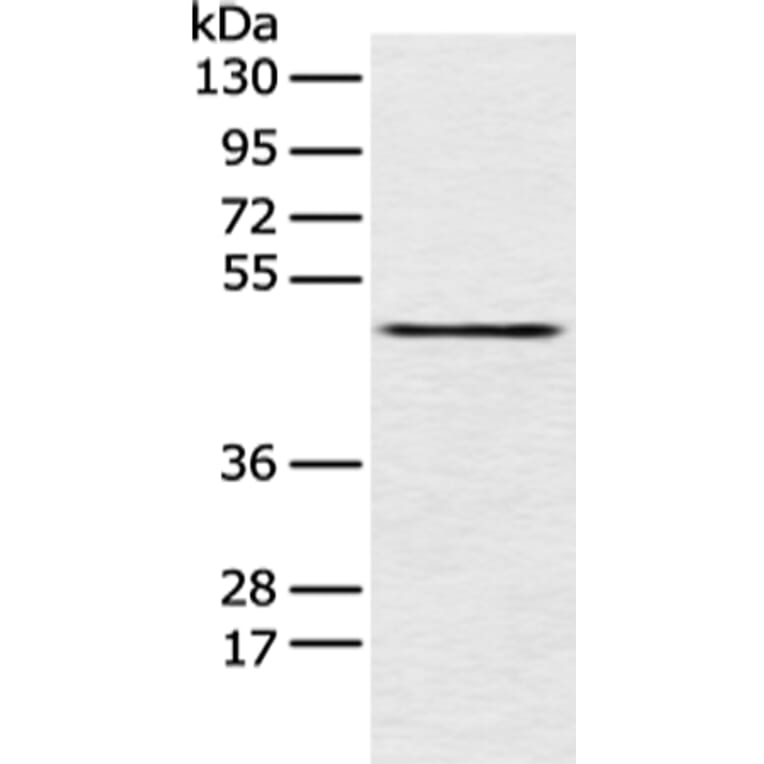 PCID2 Antibody from Signalway Antibody (42887) - Antibodies.com