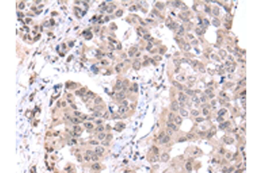 Immunohistochemistry - PCID2 Antibody from Signalway Antibody (42887) - Antibodies.com