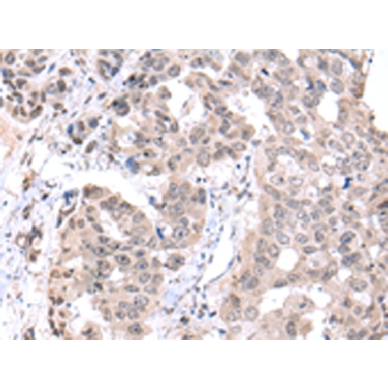 Immunohistochemistry - PCID2 Antibody from Signalway Antibody (42887) - Antibodies.com