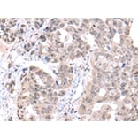 Immunohistochemistry - PCID2 Antibody from Signalway Antibody (42887) - Antibodies.com