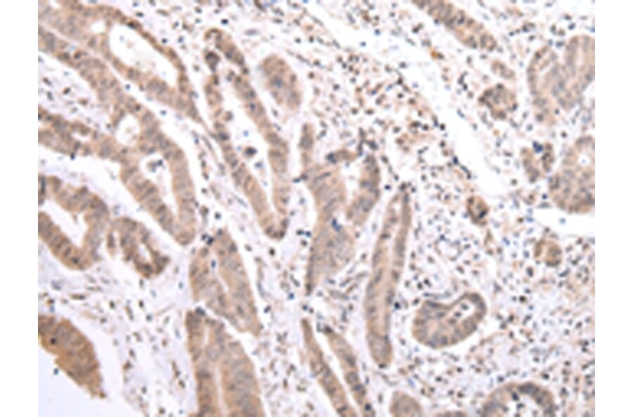 Immunohistochemistry - PCID2 Antibody from Signalway Antibody (42887) - Antibodies.com