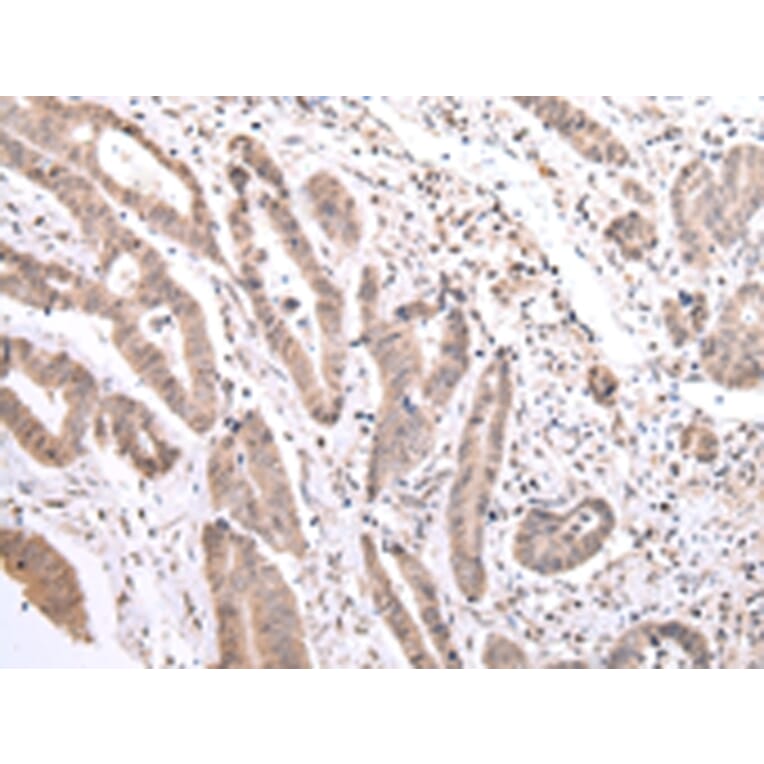 Immunohistochemistry - PCID2 Antibody from Signalway Antibody (42887) - Antibodies.com