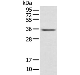 ACBD4 Antibody from Signalway Antibody (42905) - Antibodies.com