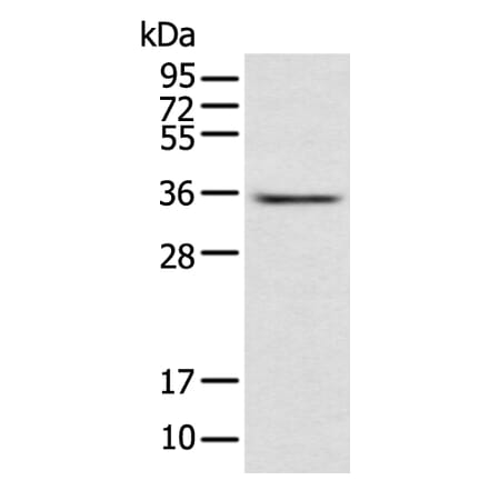 ACBD4 Antibody from Signalway Antibody (42905) - Antibodies.com
