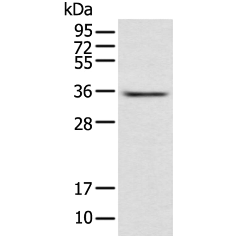 ACBD4 Antibody from Signalway Antibody (42905) - Antibodies.com
