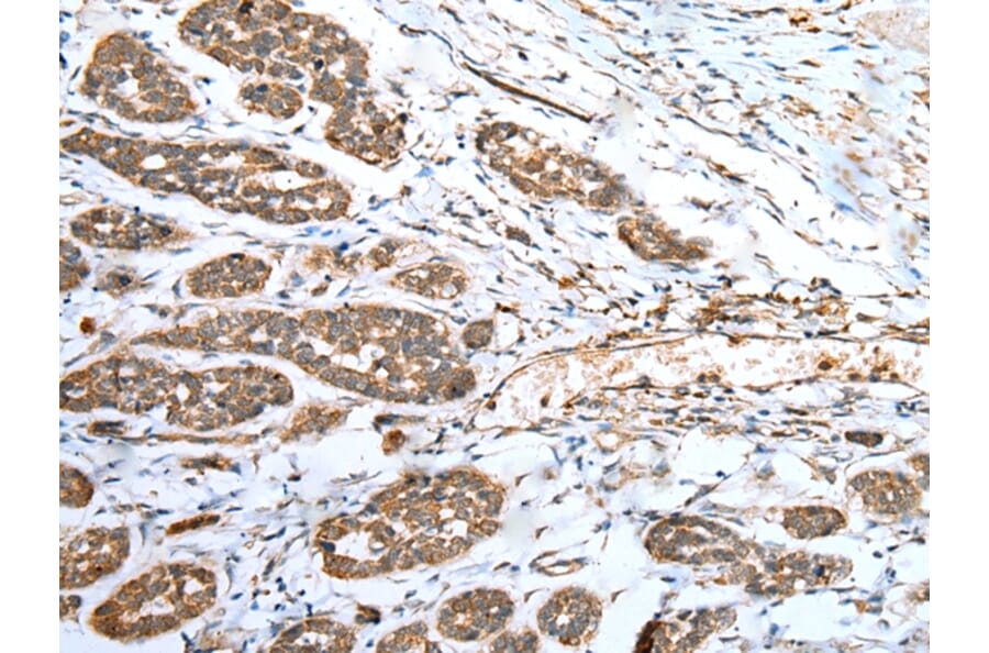 Immunohistochemistry - ACBD4 Antibody from Signalway Antibody (42905) - Antibodies.com