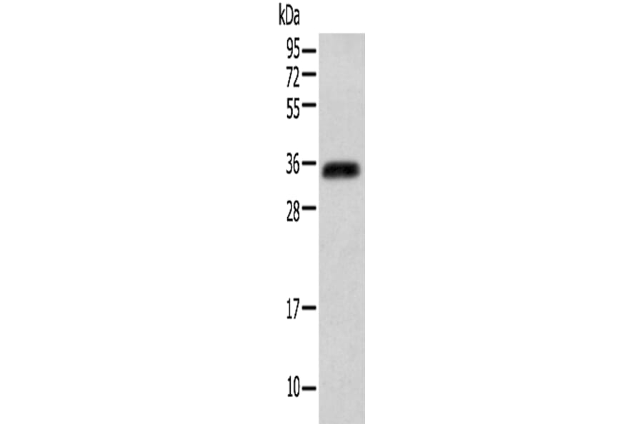 ITLN2 Antibody from Signalway Antibody (42927) - Antibodies.com
