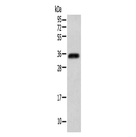 ITLN2 Antibody from Signalway Antibody (42927) - Antibodies.com