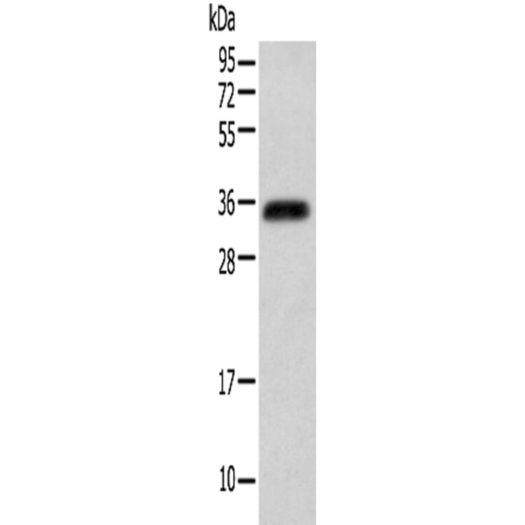ITLN2 Antibody from Signalway Antibody (42927) - Antibodies.com