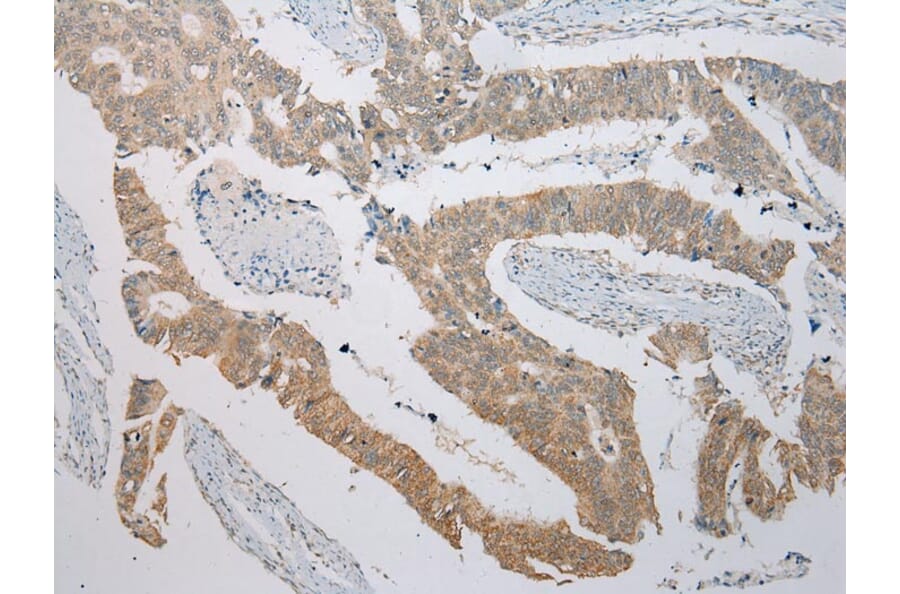 Immunohistochemistry - ITLN2 Antibody from Signalway Antibody (42927) - Antibodies.com